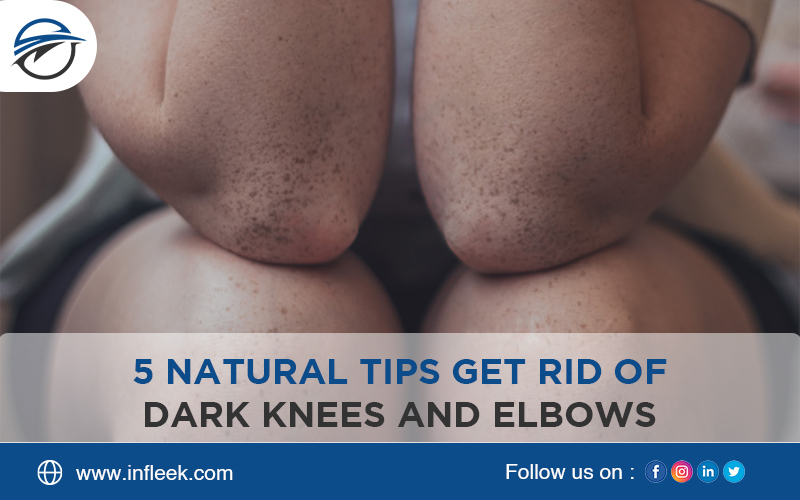 natural tips get rid of dark knees